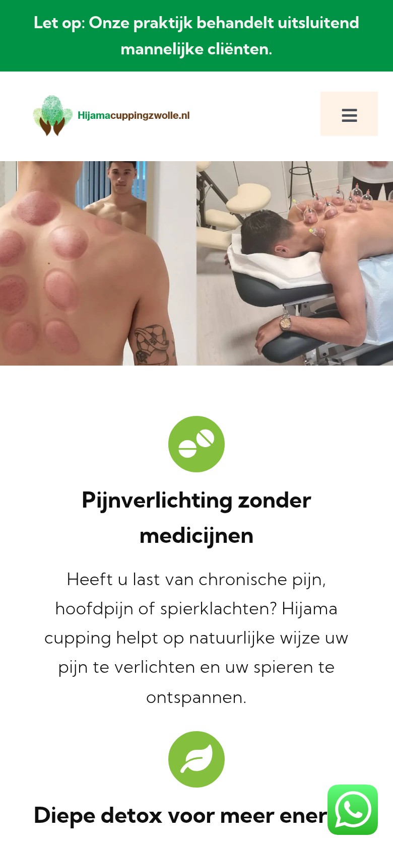 Hijama Cupping